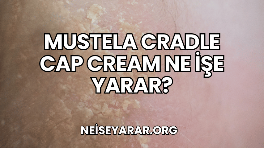 Mustela Cradle Cap Cream Ne İşe Yarar