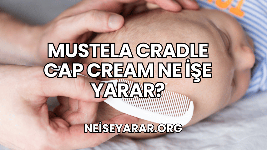 Mustela Cradle Cap Cream Ne İşe Yarar