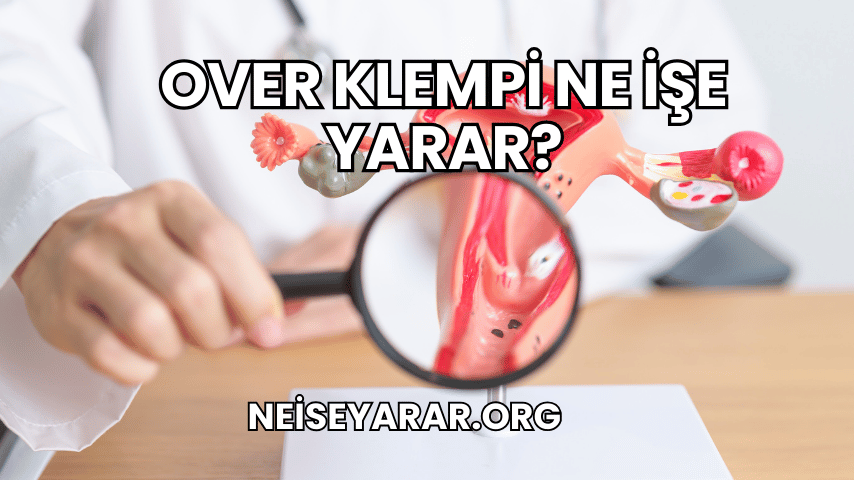 Over Klempi Ne İşe Yarar?