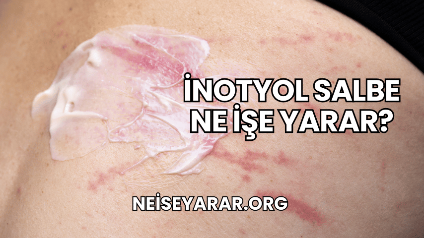 İnotyol Salbe Ne İşe Yarar?